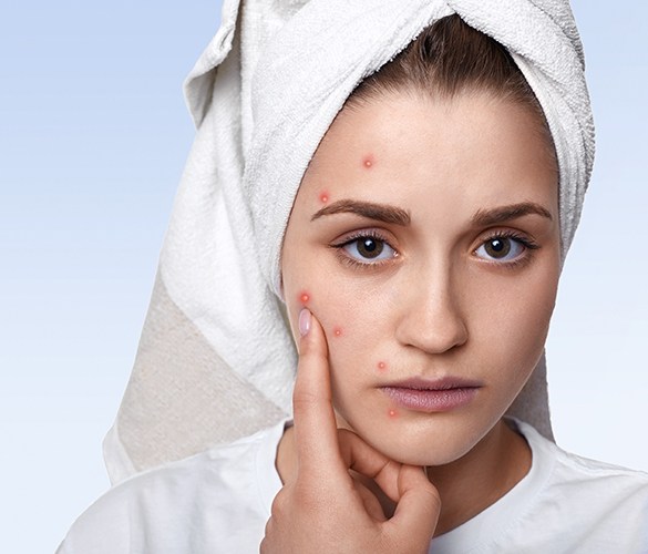 Warts Treatment by Homeopathy