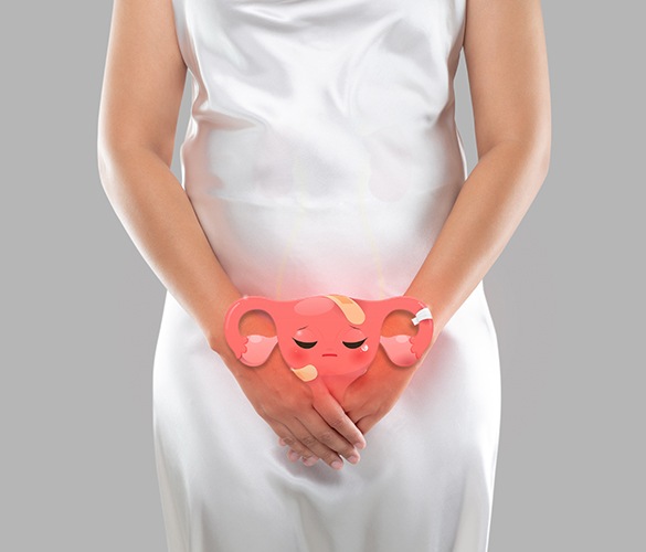 Leucorrhoea Treatment by Homeopathy